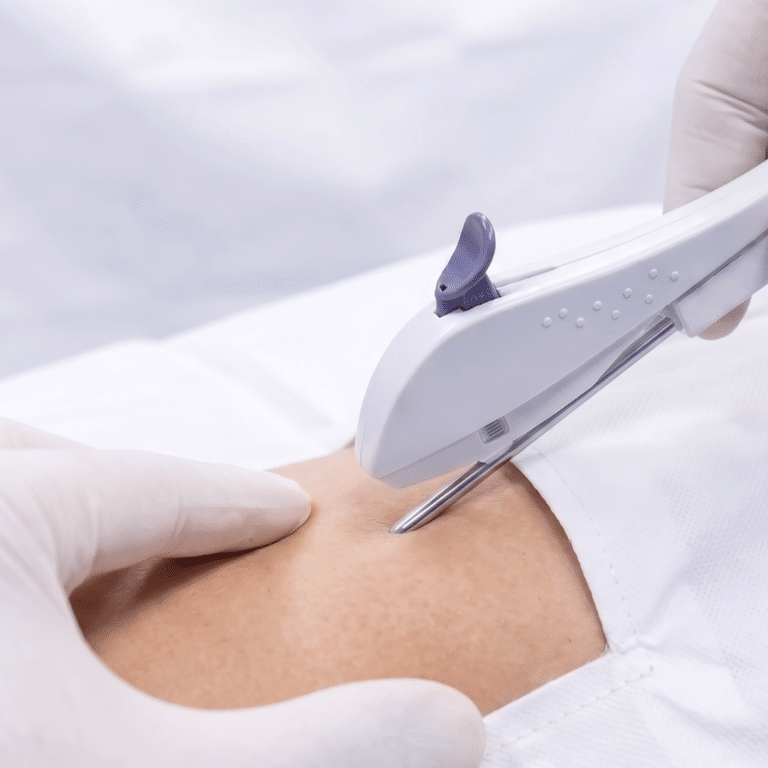 Nexplanon & Hormonal IUD Placement