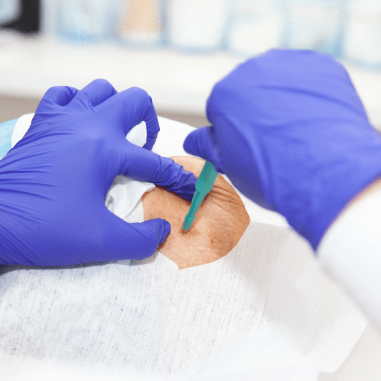Skin Biopsies & Excisions